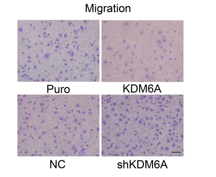 T24 Puro/KDM6A和NC/shKDM6A细胞上清对小鼠骨髓来源巨噬细胞（BMDM）趋化的影响